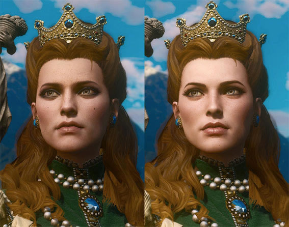 巫师3去斑美容MOD_巫师3:狂猎角色去斑美容高清MOD整合包-开心电玩