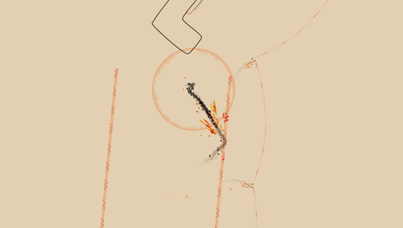 Ynglet����_Ynglet���İ�����